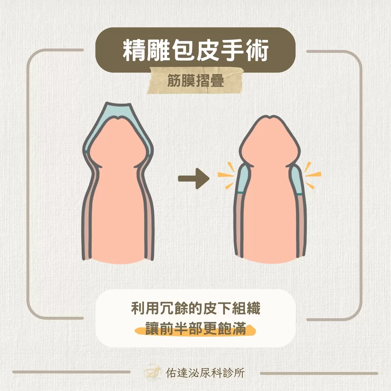 尚無圖片