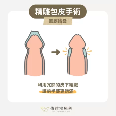 尚無圖片