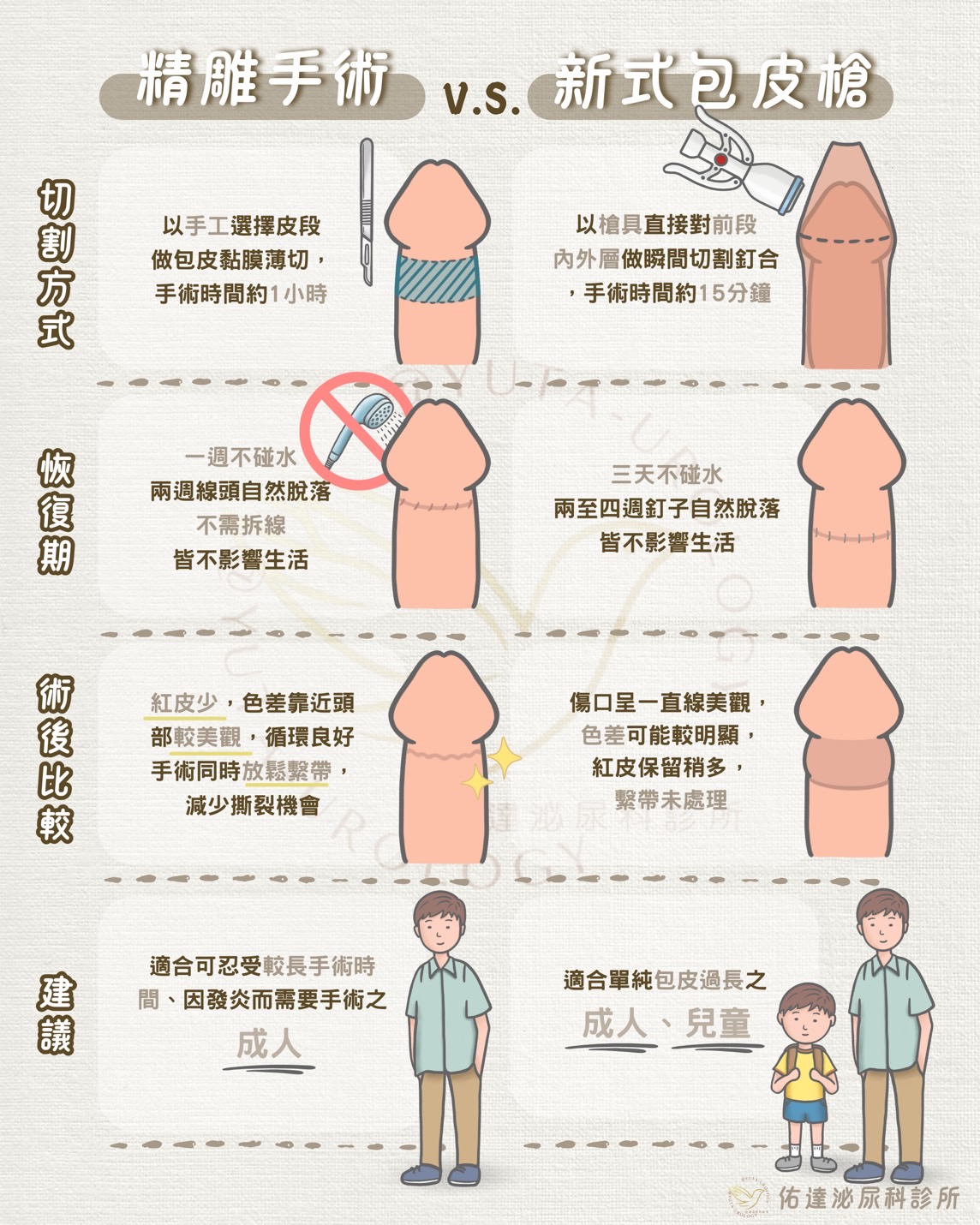 包皮槍手術與傳統精雕包皮手術選擇