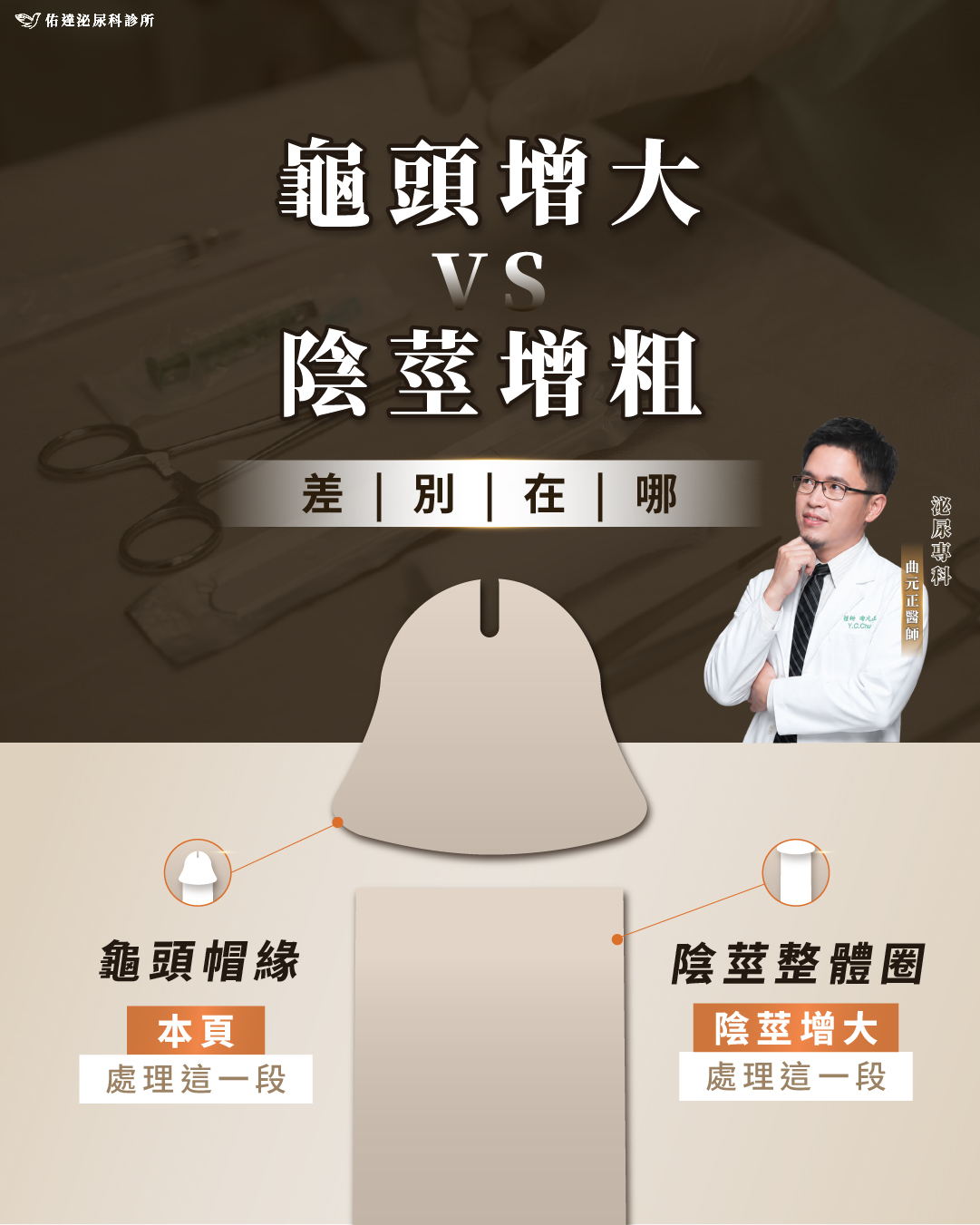 龜頭增大與陰莖體增粗處理範圍對照示意圖