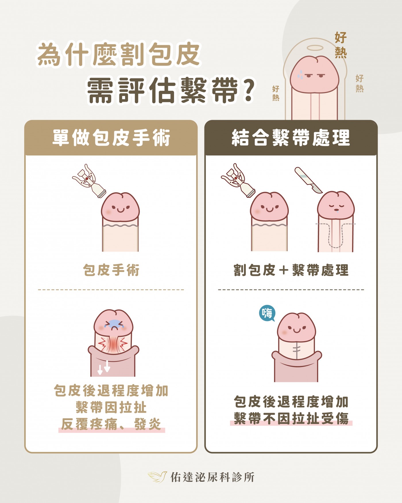 包皮手術文章圖片 3