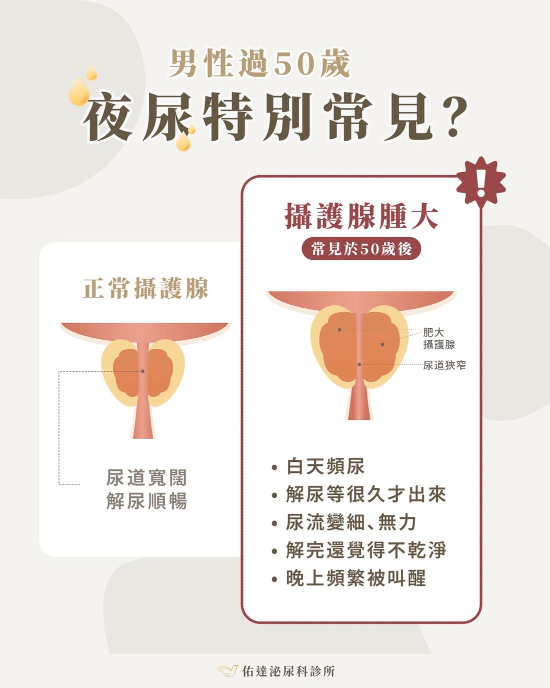 正常攝護腺 vs 攝護腺腫大 - 50 歲後常見變化 - 佑達泌尿科